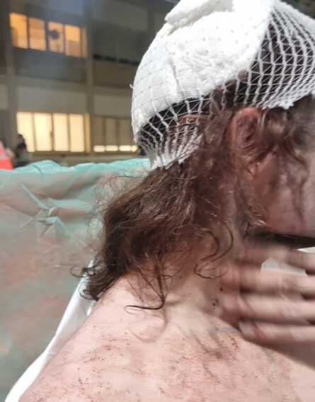 Aggressione omofoba Parco Rossani Bari